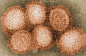 Flu-Vaccine-and-2015-Epidemic